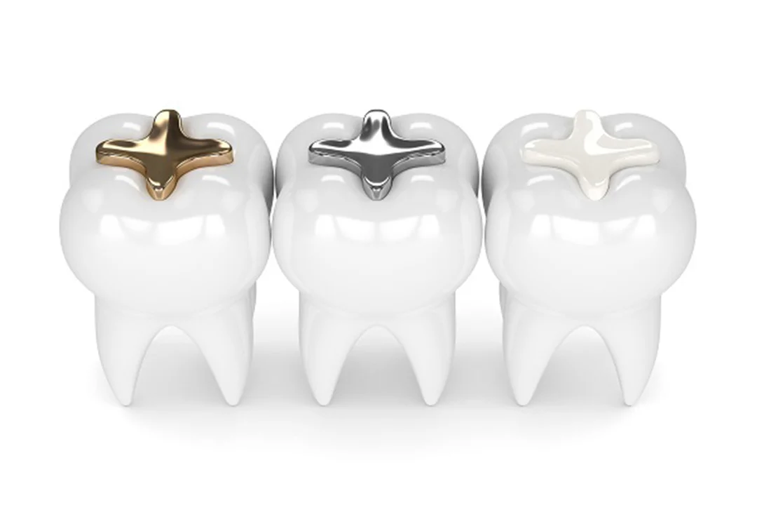 Dental Fillings