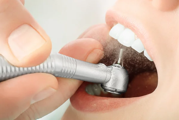 Teeth Restoration